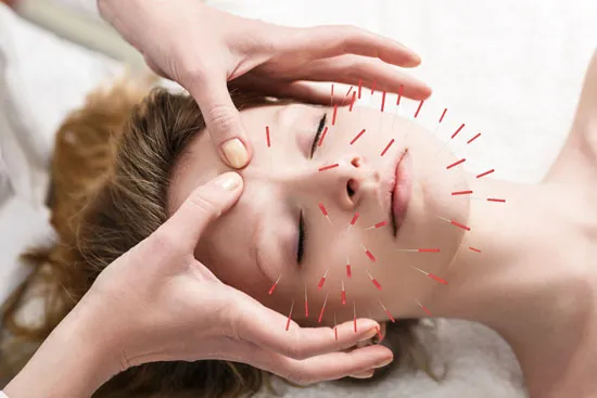 Does acupuncture detox your body?