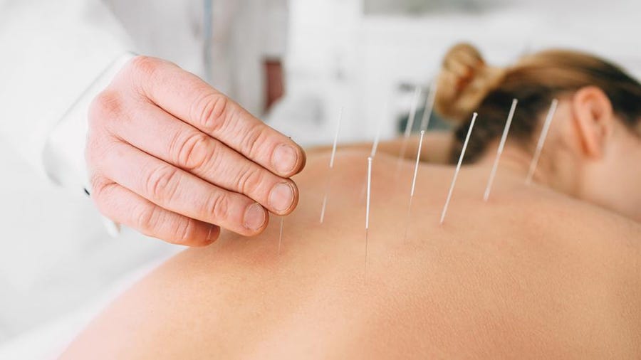 Does acupuncture get rid of inflammation?