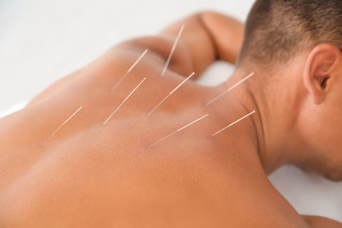 How reliable is acupuncture?