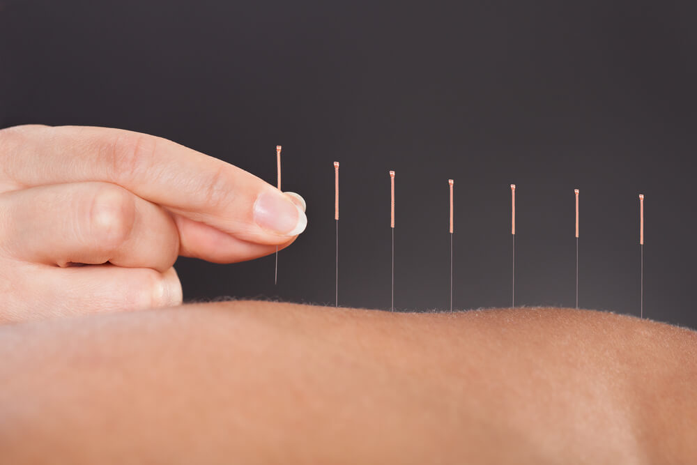 Why do doctors not recommend acupuncture?